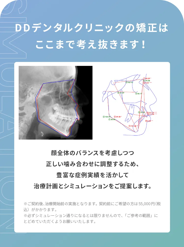 DDデンタルクリニックの矯正はここまで考え抜きます!
