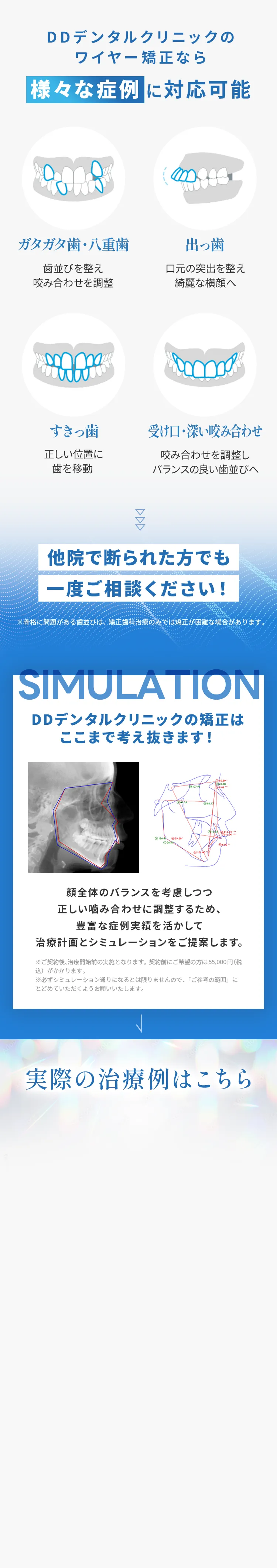 実際の治療例はこちら